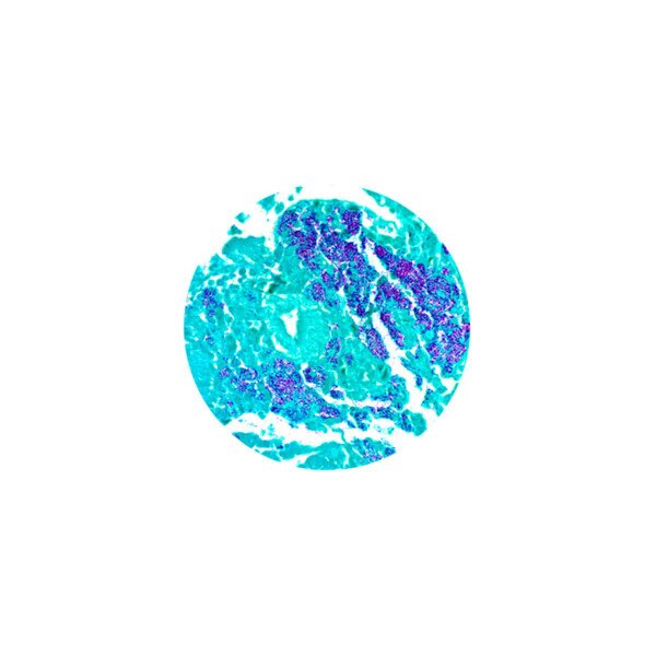 Acid Fast Bacteria (AFB) Stain Kit